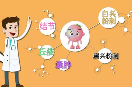 痤疮科普4.jpg 痤疮科普4.jpg