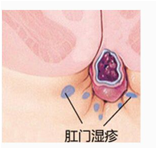 冷热湿敷缓解术后疼痛2.png