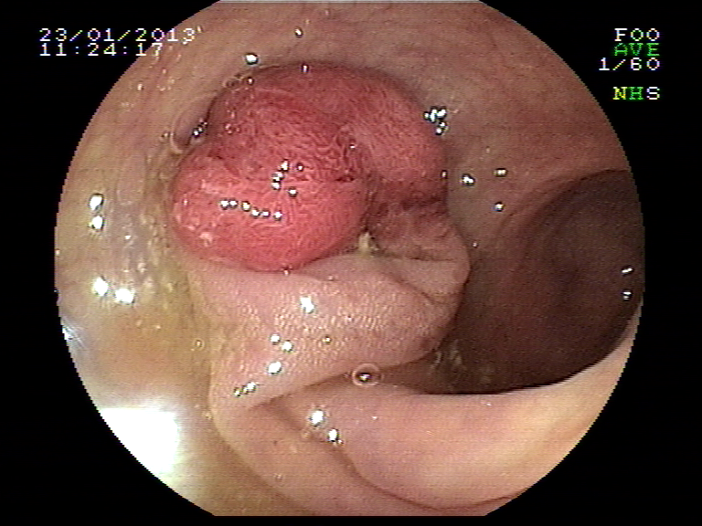 Image15.bmp